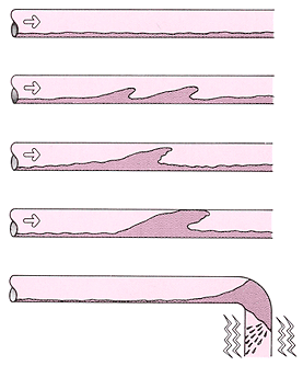 ウォーターハンマーの発生図